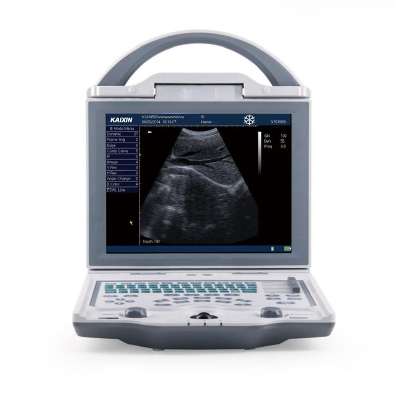Échographe portable KX5600 noir et blanc avec sonde convex
