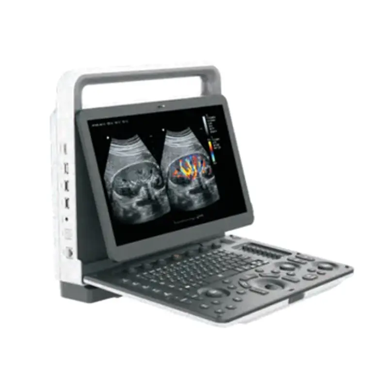 Échographe portable Zoncare M30 — couleur, écran Full HD 15,6"
