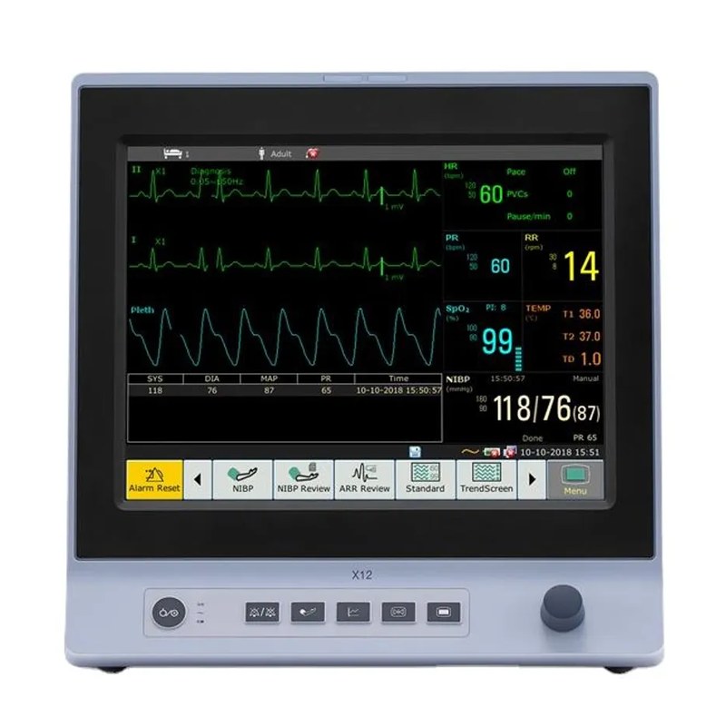 Moniteur patient multiparamétrique EDAN X12 avec écran couleur affichant ECG, SpO₂ et pression